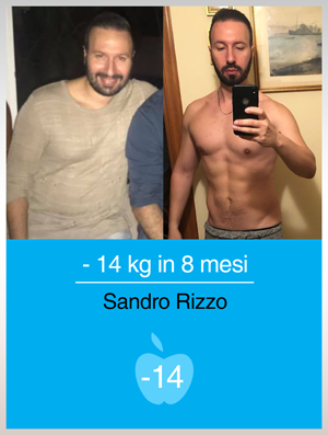 prima-dopo-rizzo