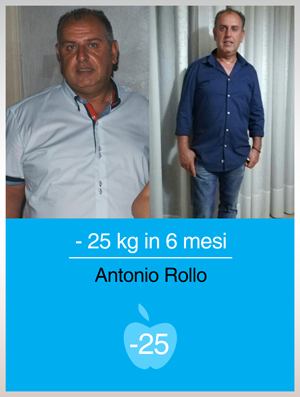 prima-dopo-rollo-antonio